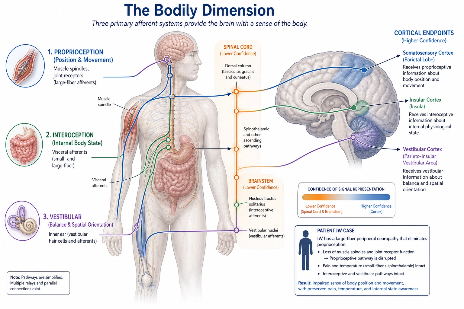 The Bodily dimension: three pathways (proprioception, interoception, vestibular) from receptors through spinal/brainstem pathways (lower confidence) to cortical endpoints (higher confidence). Patient IW case: large-fiber neuropathy eliminated proprioception while pain and temperature remained intact.